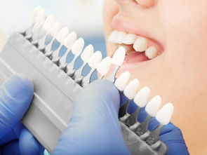 口腔健康“贵族化” 从种植牙到日常用品的市场垄断与消费反思